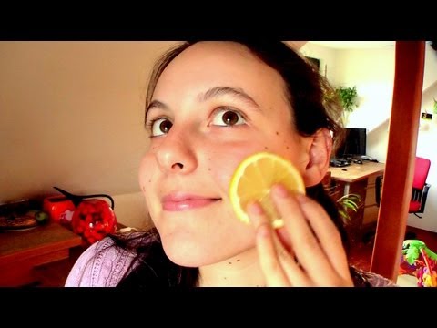 lemon juice acne remedies