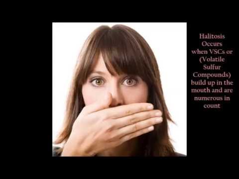 halitosis treatment