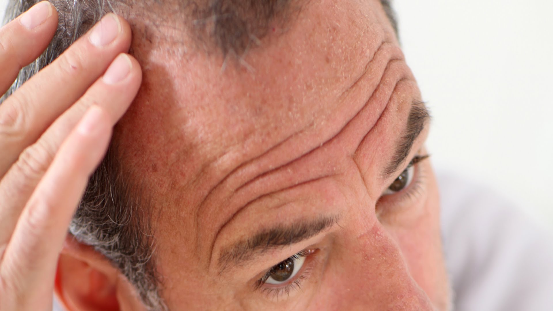 how to get finasteride for hair loss