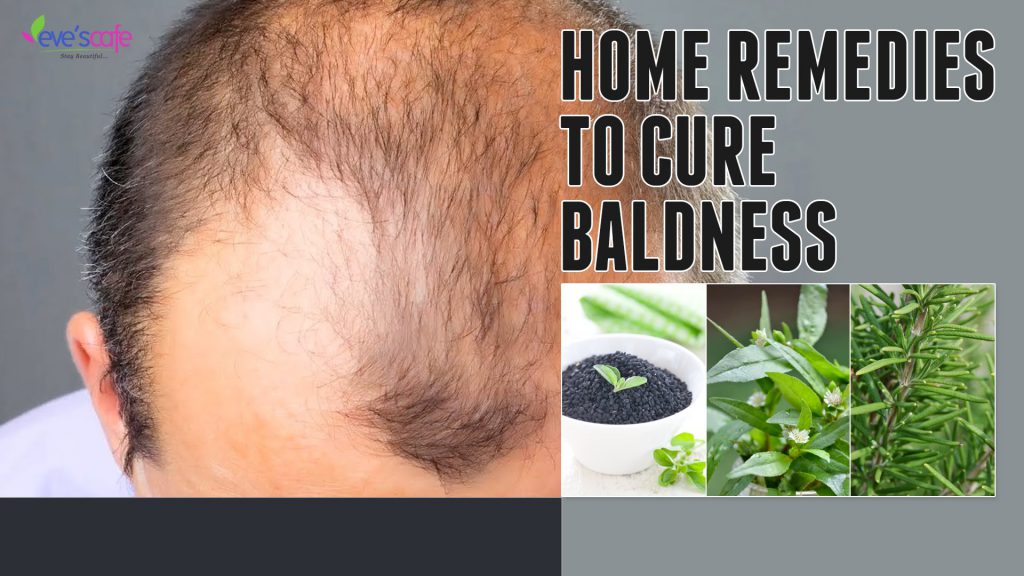 How To Treat Baldness Or Regrow Hair On Bald Spot HOME REMEDY Man 