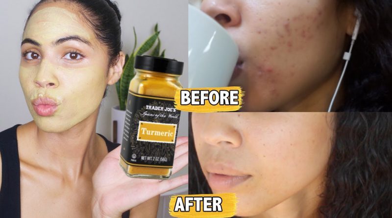 Proof That Turmeric For Acne WORKS and HOW To Use It