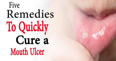 5 remedies to quickly cure a mouth ulcer | Natural Health