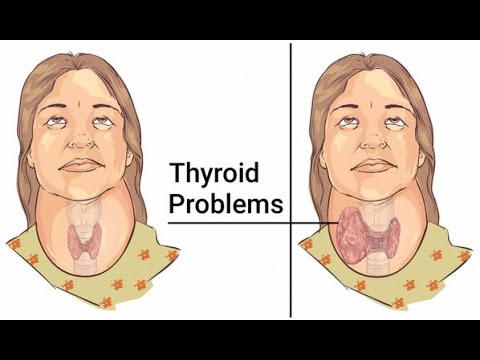 According To Science These 11 Foods Can Heal Your Thyroid