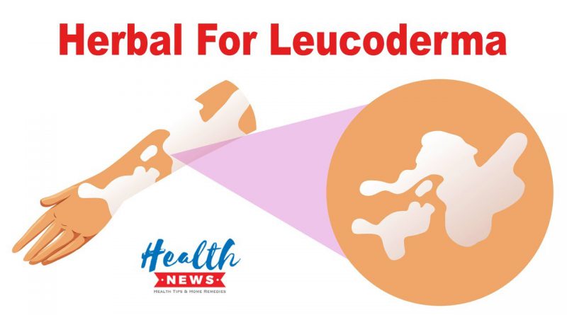 Herbal For Leucoderma - Which Will Work For You