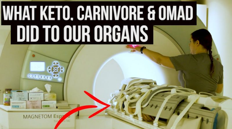 Keto, Carnivore & OMAD Put to the Test {full body MRI scan}
