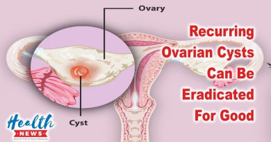 Recurring Ovarian Cysts Can Be Eradicated For Good