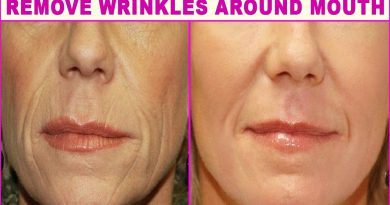 Top 5 Natural Home Remedies For Wrinkles Around The Mouth