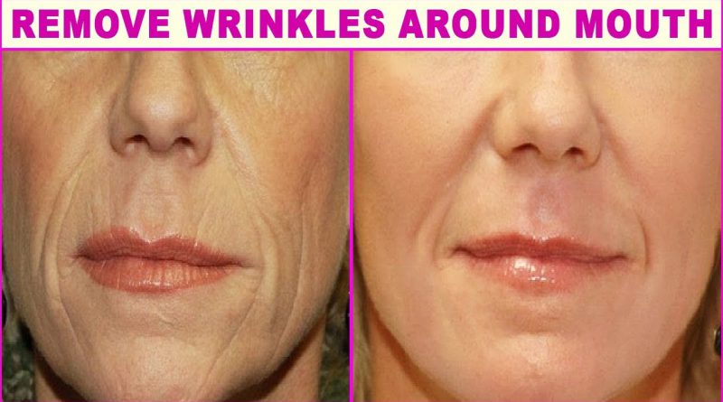 Top 5 Natural Home Remedies For Wrinkles Around The Mouth
