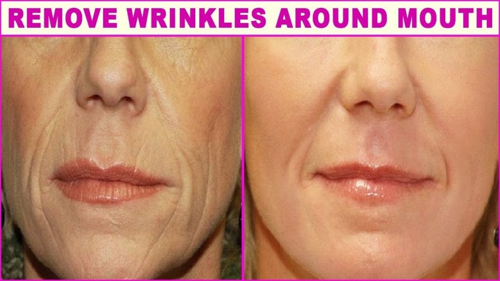 Top 5 Natural Home Remedies For Wrinkles Around The Mouth – Man-Health