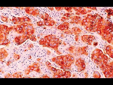 Unapproved but Effective Cancer Treatments That Helped Thousands To Cure Cancer