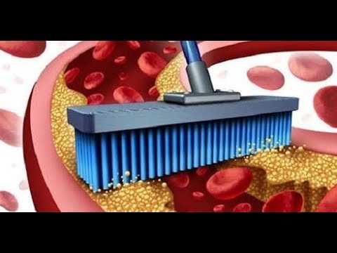 12 Foods that You Should Eat Daily for Clean Arteries
