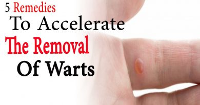 5 Remedies To Accelerate The Removal Of Warts | Natural Health