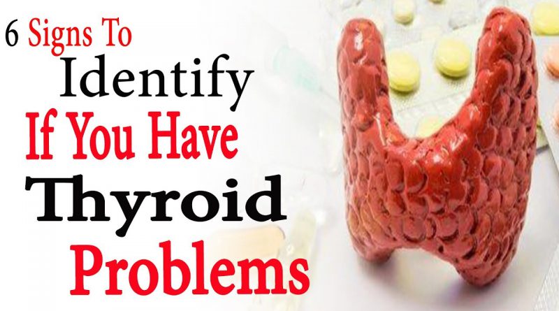 6 signs to identify if you have thyroid problems | Natural Health
