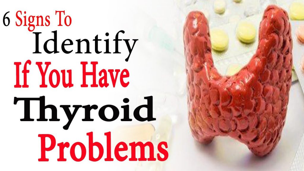 6 signs to identify if you have thyroid problems | Natural Health – Man ...