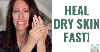 How To Heal Dry Cracked Hands & Heels Naturally | 3 EASY Cold Weather Skin Care Tips