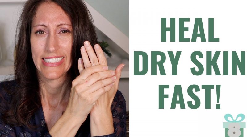 How To Heal Dry Cracked Hands & Heels Naturally | 3 EASY Cold Weather Skin Care Tips