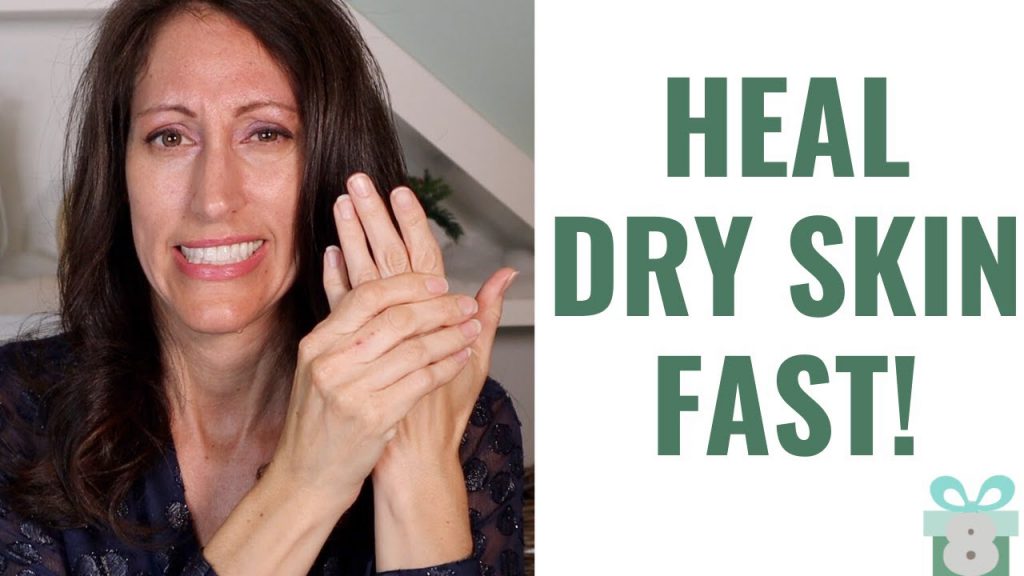 How To Heal Dry Cracked Hands & Heels Naturally 3 EASY Cold Weather