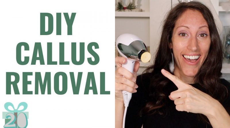 How toTreat Calloused Rough Heels Naturally | FAST Callus Removal on Feet