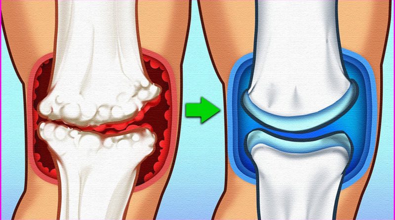 If You Want To Relieve The Pain Of Your Joints Quickly Start Eating These 15 Foods