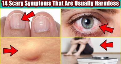 These 14 Common Scary Symptoms That Are Usually Harmless
