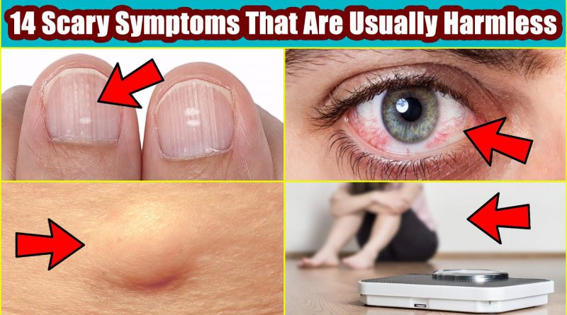 These 14 Common Scary Symptoms That Are Usually Harmless