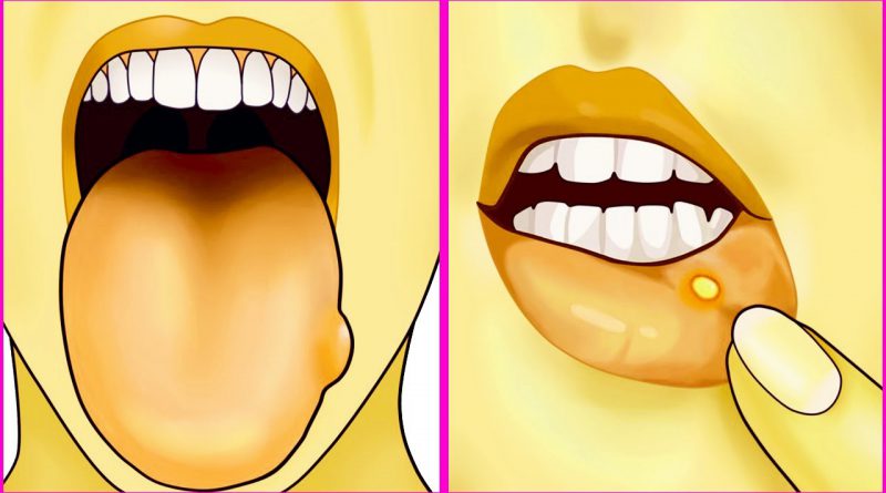 These 7 Signs Might Mean Your Body Needs More Folic Acid