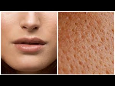 This is The Only Effective Way to Shrink Pores on Your Face