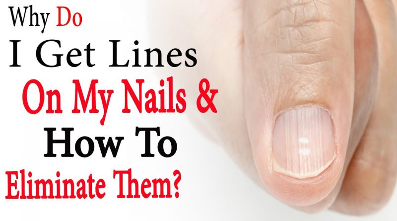 Why do I get lines on my nails and how to eliminate them | Natural Health