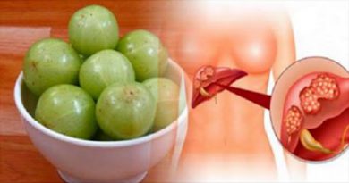 Benefits of Amla |  It Is The Most Powerful Antioxidant, Has 20 Times More Vitamin C Than Oranges