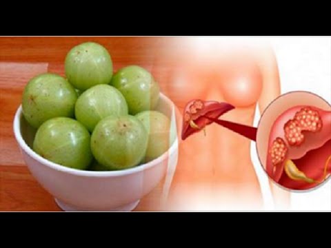Benefits of Amla |  It Is The Most Powerful Antioxidant, Has 20 Times More Vitamin C Than Oranges