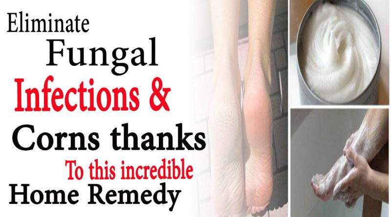 Eliminate fungal infections and corns thanks to this incredible home remedy | Natural Health