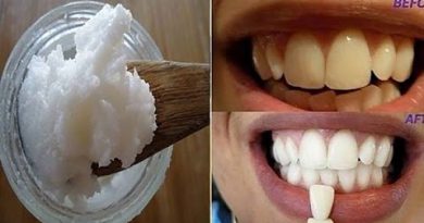GARGLE WITH ONE SIMPLE INGREDIENT AND SEE WHAT HAPPENS TO YOUR TEETH!