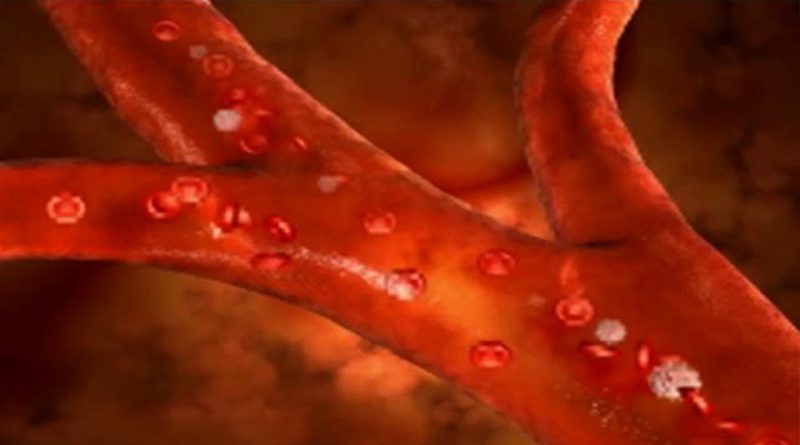 Health Tips - Warning Signs Of High Blood Pressure That You Shouldn’t Ignore