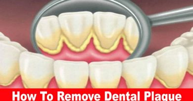 How To Remove Dental Plaque In 5 Minutes Naturally
