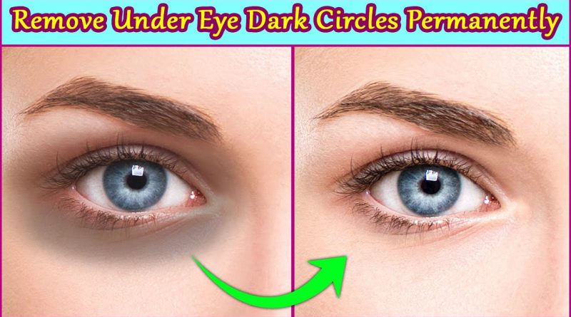 Remove Under Eye Dark Circles Permanently 5 Easy Natural Home Remedies