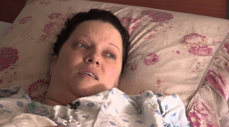 Weight Loss Journey: Episode 3 - The Day After Surgery