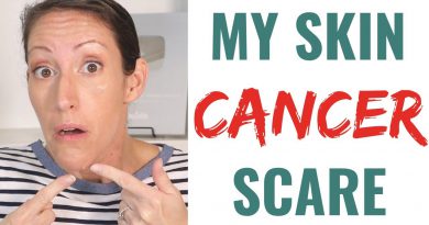 How to AVOID & Prevent Skin Cancer!  WATCH If You Have Moles on Your Body!