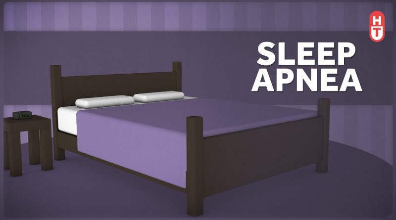 Sleep Apnea, CPAP, and Barriers to Care in the US