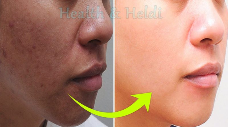 Apply This Face Mask On Your Skin To Get White, Glowing And Spotless Skin । Skin Whitening Mask