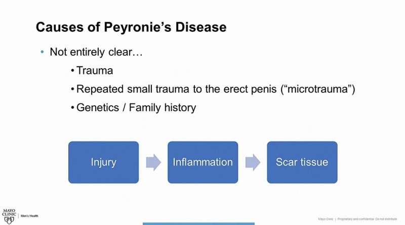 Men's Health Moment: Peyronie's Disease Introduction and Overview