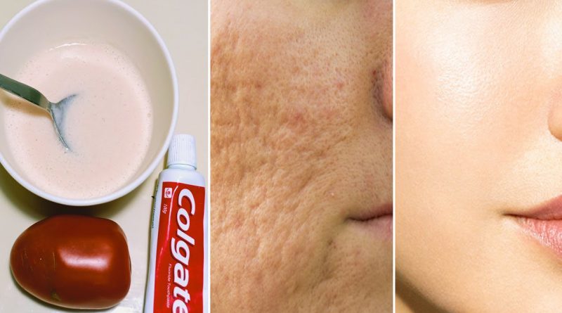 Tomato With Toothpaste Face Mask Close Large Open Pores Remove Dark Spots And Pigmentation