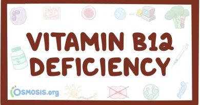 Vitamin B12 deficiency - causes, symptoms, diagnosis, treatment, pathology