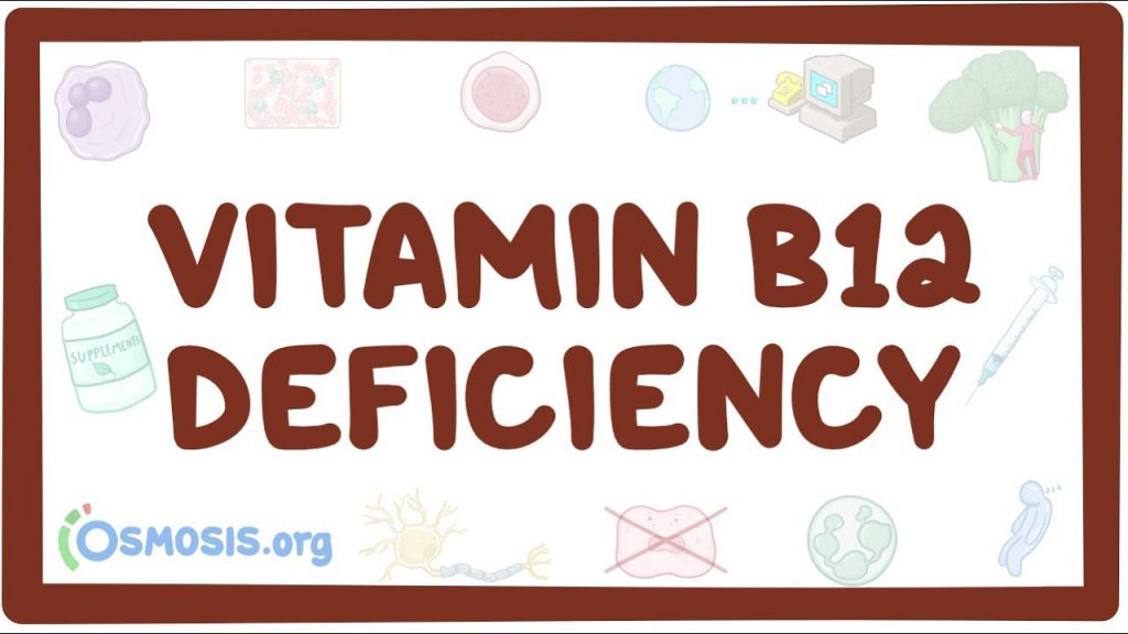 vitamin-b12-deficiency-causes-symptoms-diagnosis-treatment