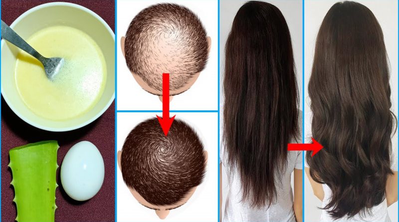Aloe Vera And Egg Hair Mask | Fast Hair Growth | Stop Hair Loss | Hair Growth Home Remedy
