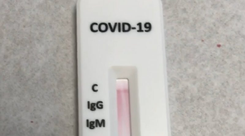 Antibodies Were Negative, Zinc Taste Test and More