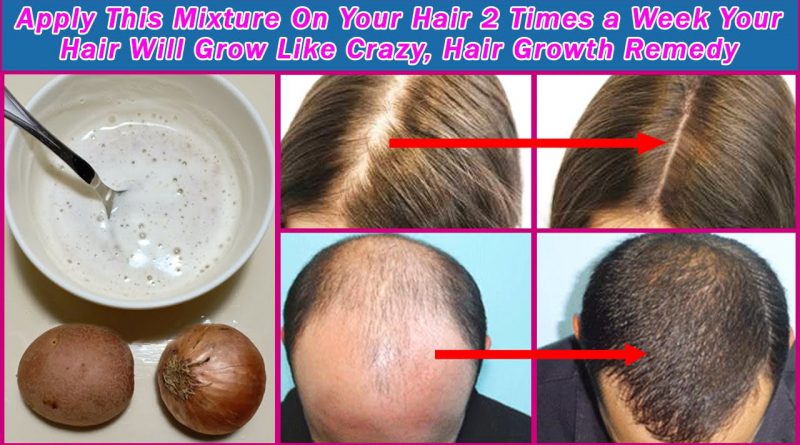 Apply This Mixture On Your Hair 2 Times a Week Your Hair Will Grow Like Crazy, Hair Growth Remedy