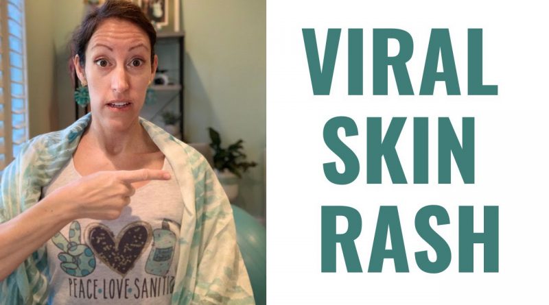 COVID Toes: NEW Virus Related Skin Rash Symptom & Toe Wounds | Natural Skin Healing Remedies