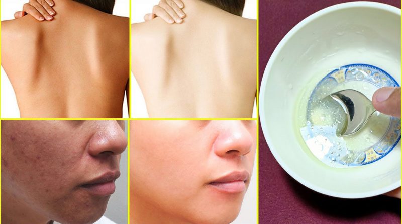 Vitamin E And Aloe Vera Skin Whitening Mask, Get Fair Spotless Glowing Skin Naturally At Home