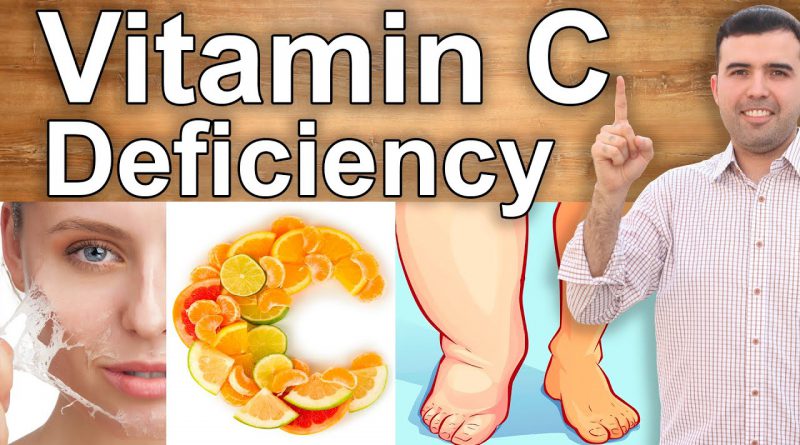 YOUR BODY IS SCREAMING IN NEED FOR VITAMIN C - Vitamin C Deficiency Symptoms and Its Benefits