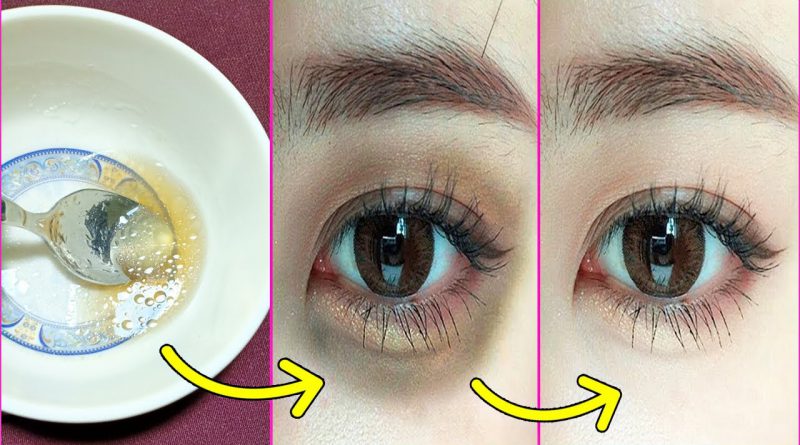 How To Get Rid Of Under Eye Dark Circles Permanently With Using This Best Natural Home Remedy